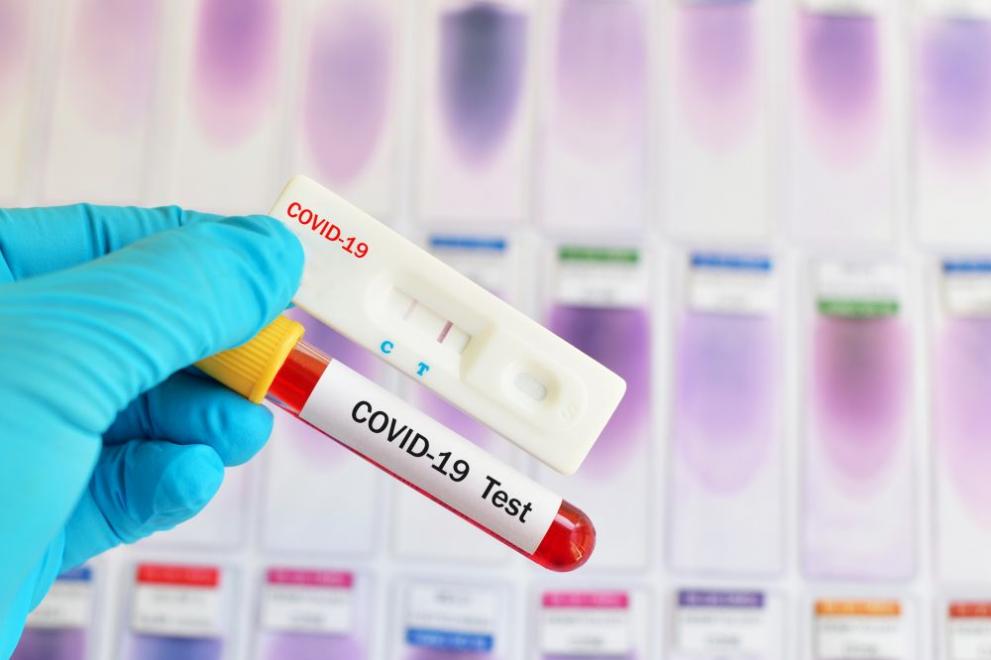991-ratio-koronavirus-pcr-test